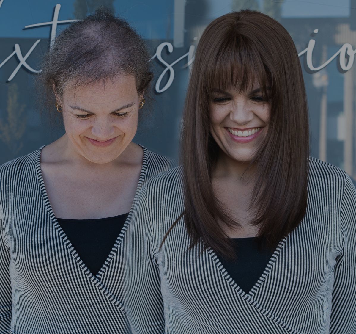 Hair loss client before and after