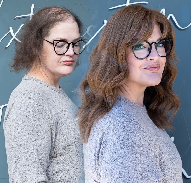 Full-time hair loss client before and after
