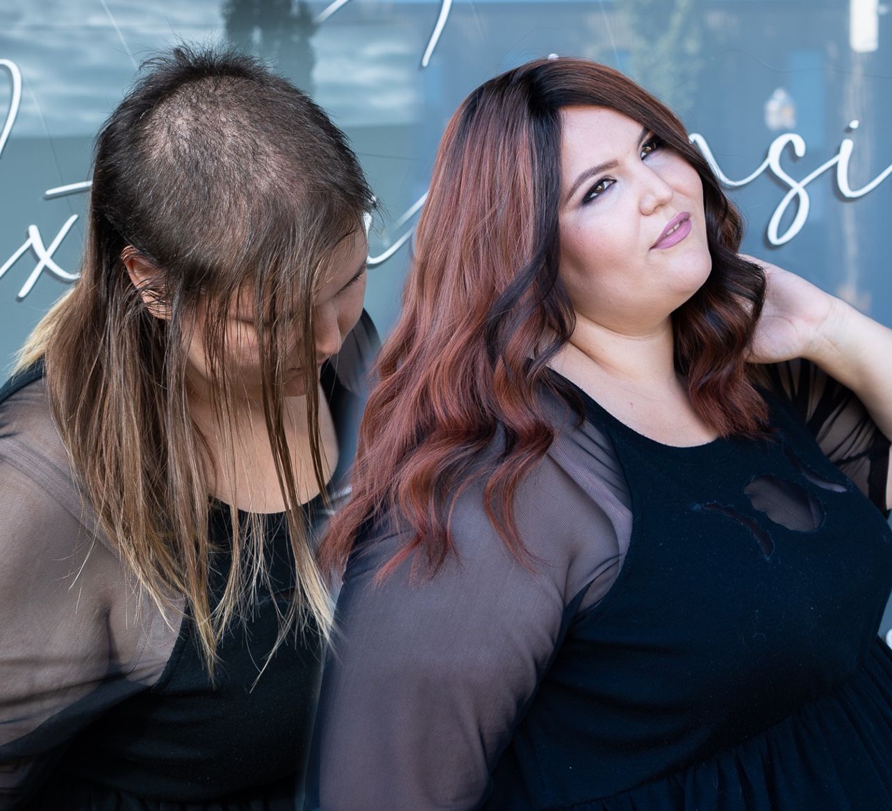 Two looks from one hair loss client